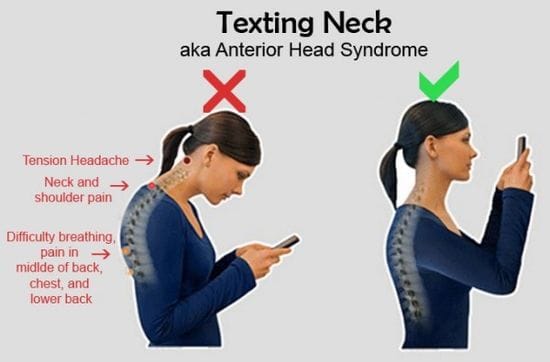 Texting Neck: Is texting causing your neck pain?